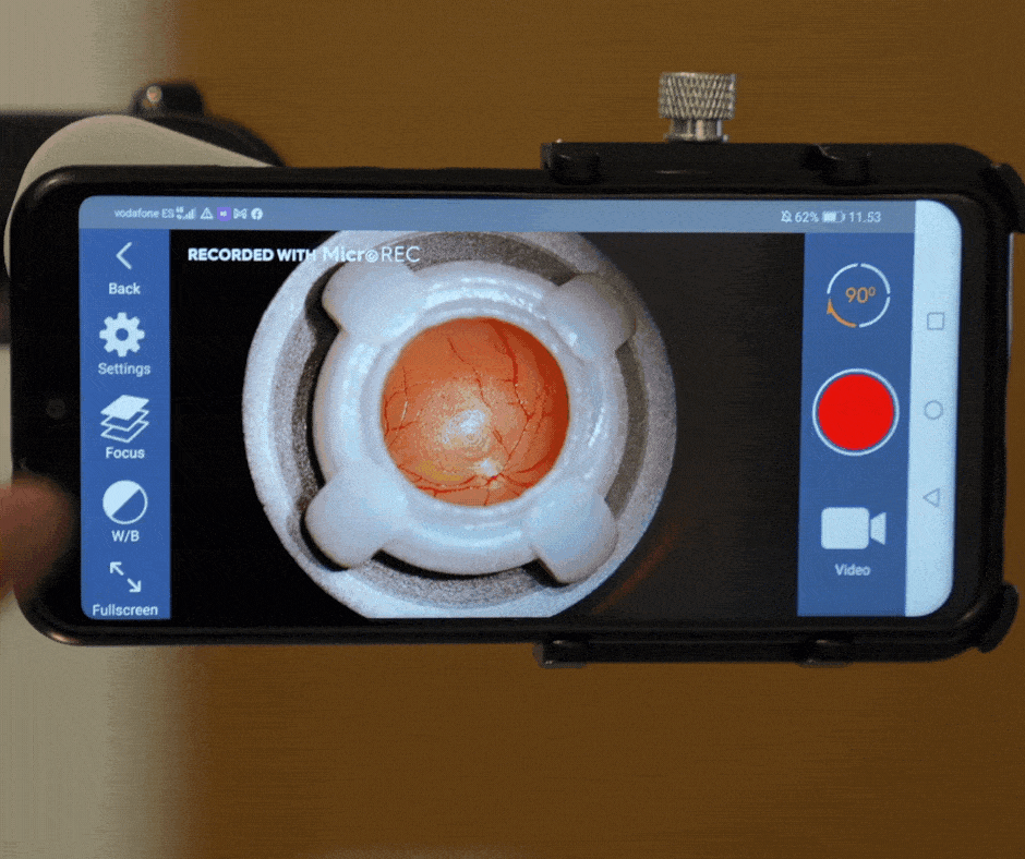 Some configurations of MicroREC App