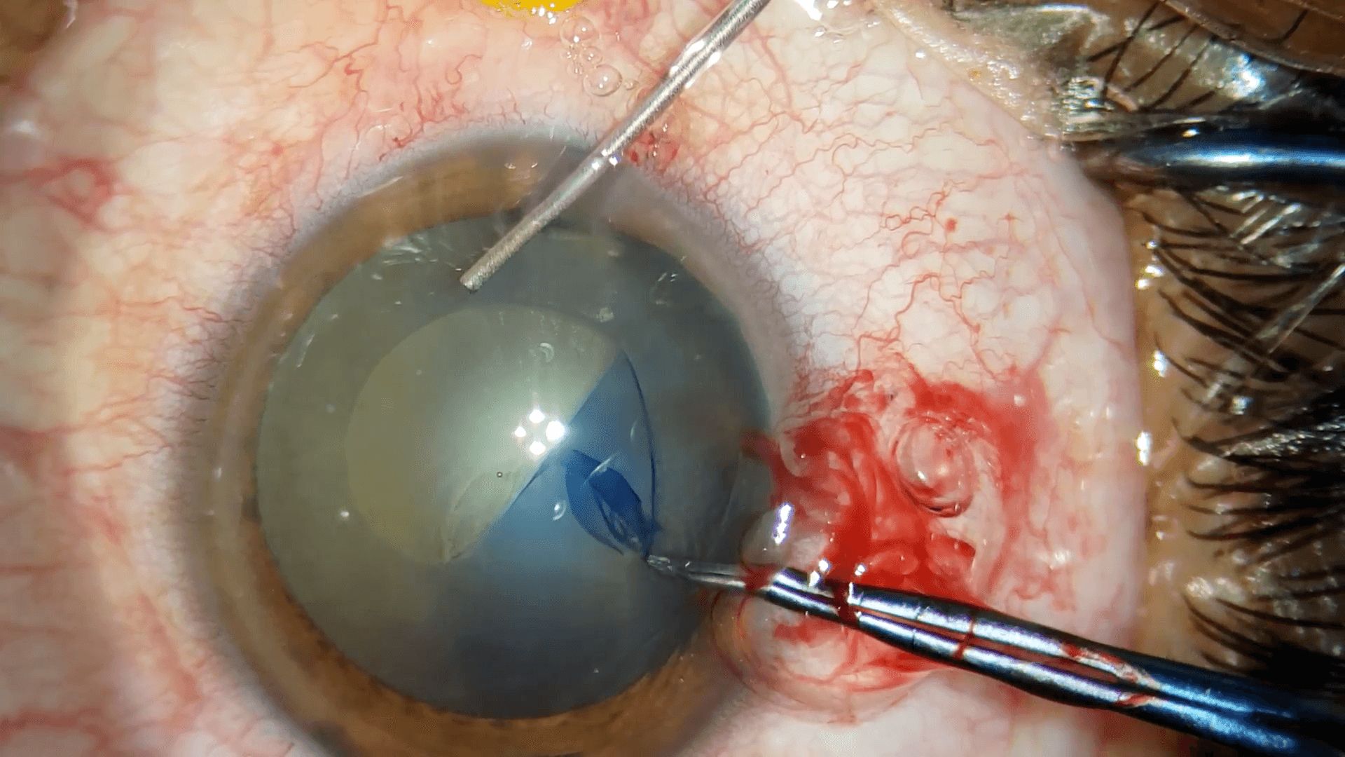 Why are high-quality images so important in ophthalmology?