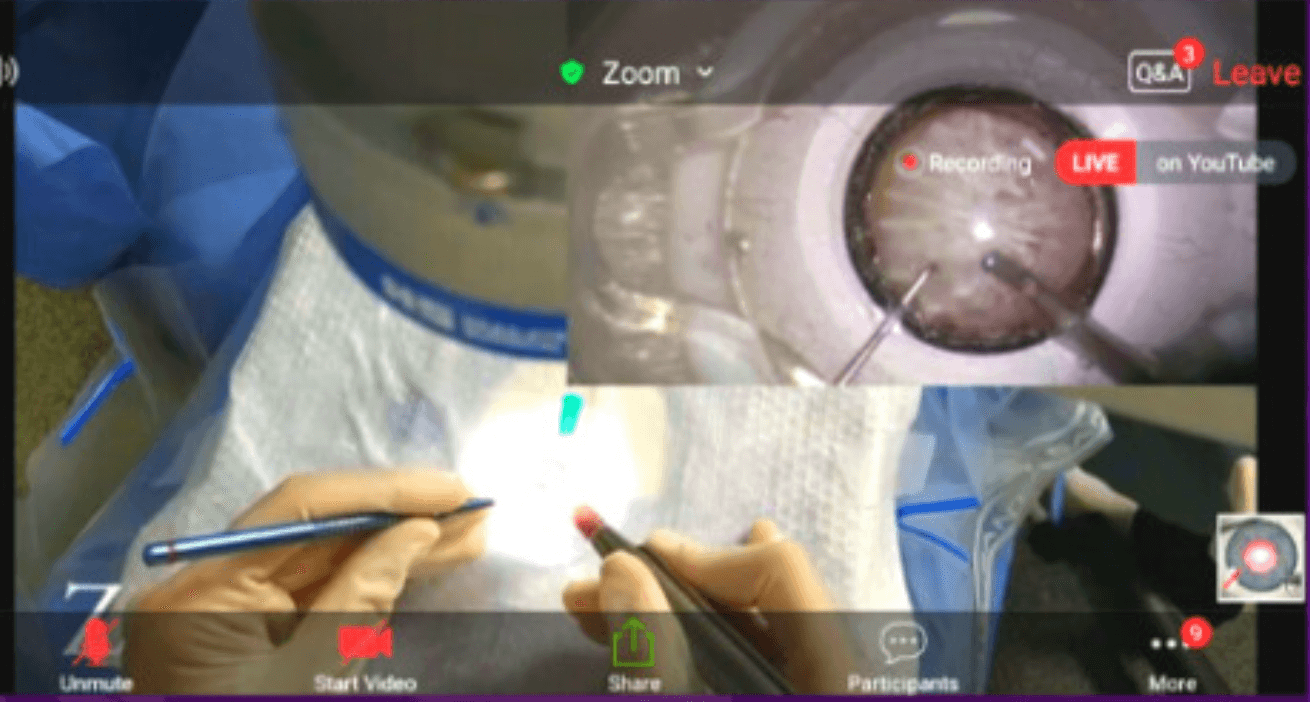 1st Ophthalmology WebLab streamed LIVE with a MicroREC