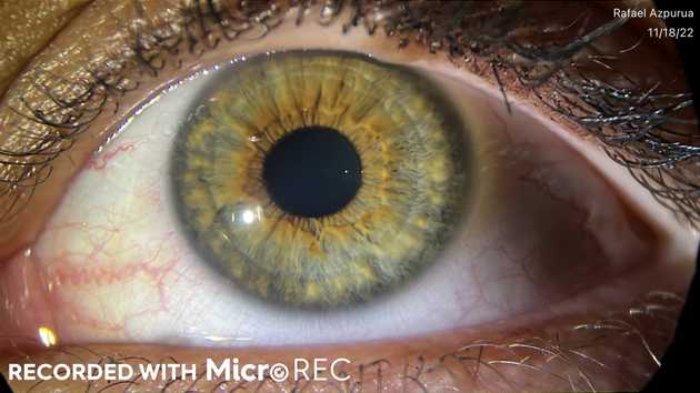 A human eye taken with an iPhone 13