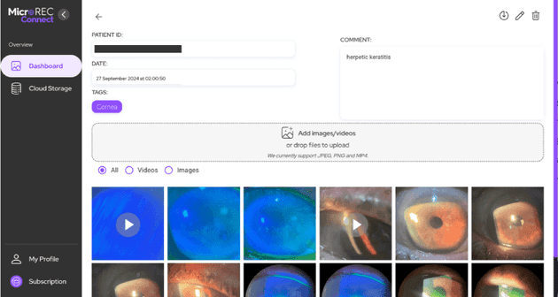 MicroREC Connect Platform for ophthalmologists